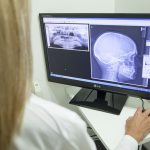 Mobilny aparat do radiografii w Podkarpackim Centrum Chorób Płuc w Rzeszowie