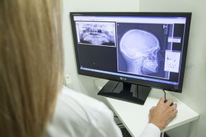 Mobilny aparat do radiografii w Podkarpackim Centrum Chorób Płuc w Rzeszowie