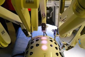 Ginekolożki przy konsoli robota. Ruszyły warsztaty chirurgii robotycznej w USK w Rzeszowie