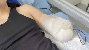 Maszyna wciągnęła i urwała mu rękę. 29-letni Piotr z Rzeszowa walczy o powrót do zdrowia