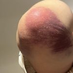 Recydywa na lodzie. Trzeci upadek mieszkańca Rzeszowa i "festiwal znieczulicy" w sieci